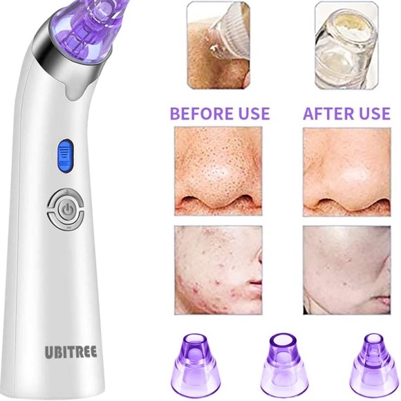 UBITREE BLACKHEAD/PORE SUCTION REMOVER - Picture 3 of 5